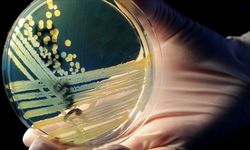 Antimikrobiyal Dirençle Mücadelede Yeni Dönem: Ulusal Eylem Planı (2026–2030) Yayımlandı