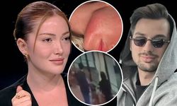 Fenomen Danla Bilic’e Yumruk Atmıştı! Eski Sevgili Berk Çetin Hakkında Karar Çıktı: 5 Ay Hapis!