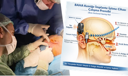 Balıkesir’de İlk Kez Uygulandı: Kemiğe İmplante İşitme Cihazı Umut Oldu