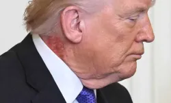 Beyaz Saray'da Panik Yaratan Fotoğraf! Trump’ın Boynundaki O İzler Neyin Habercisi? Sosyal Medya Bu Görüntüyü Konuşuyor!