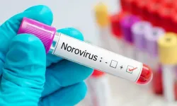 Bir Salgın Daha Patladı! 1700 Kişi Norovirüs Sebebiyle Karantinaya Alındı! Norovirüs Nedir? Nasıl Bulaşır? Ölümcül mü?