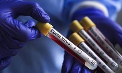 Küresel Salgın Alarmı Ortadoğu’ya Sıçradı: İsrail’de İlk Kez Bir Kişi Ebola Şüphesiyle Karantinada!