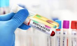 Belediyeler Çalışanlarından Uyuşturucu Testi İsteyebilir mi? İş Hukukunda Sınır Nerede?