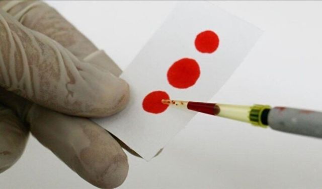 6 Milyonda Bir Görülen Altın Kan... Altın Kan Nedir? Kimlerde Bulunur?