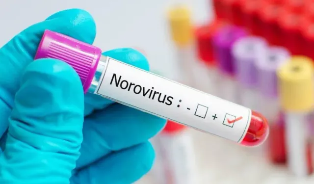 Bir Salgın Daha Patladı! 1700 Kişi Norovirüs Sebebiyle Karantinaya Alındı! Norovirüs Nedir? Nasıl Bulaşır? Ölümcül mü?