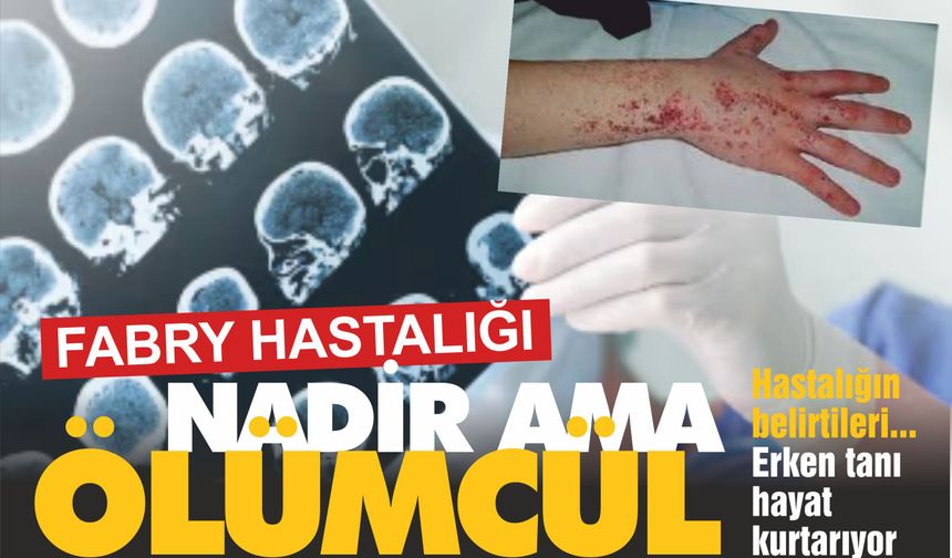 Yanma, Ağrı, Böbrek Yetmezliği… Fabry Hastalığı Sessizce İlerliyor