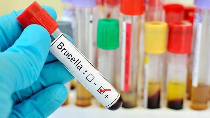 Brusella Nedir 329672 1