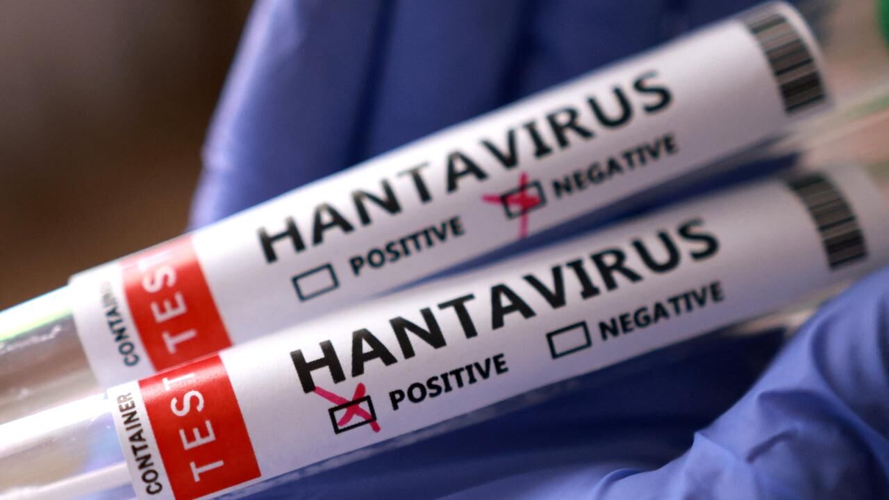 Hantavirus-1