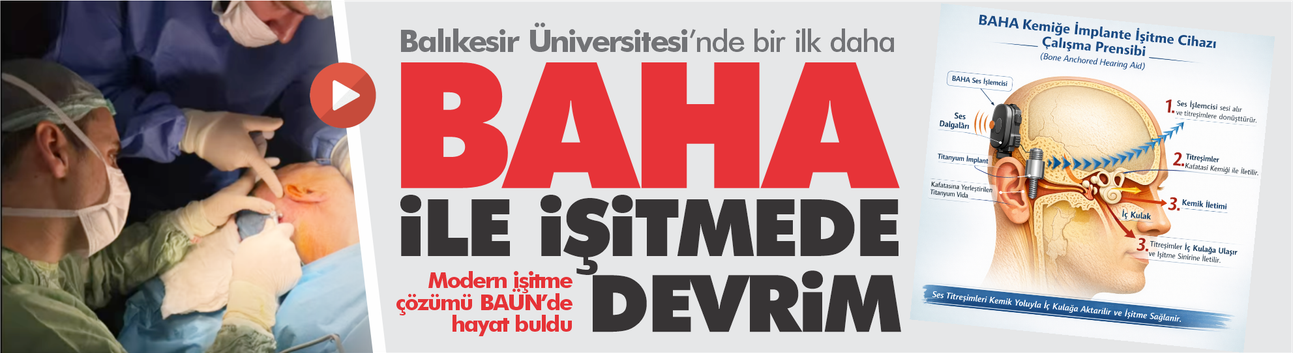 Balıkesir’de İlk Kez Uygulandı: Kemiğe İmplante İşitme Cihazı Umut Oldu